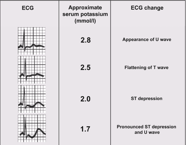 Electrocardiogram